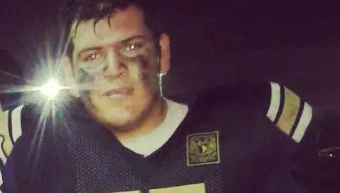 Jugador de Pumas CU, a terapia intensiva tras 'novatada'