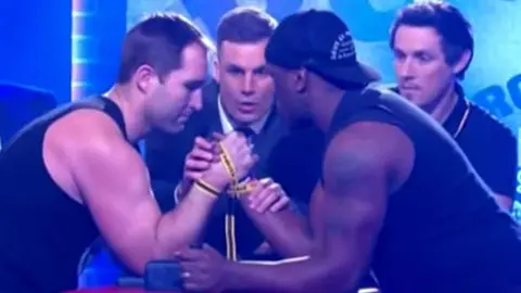 Exjugador de rugby se rompe brazo jugando a las vencidas