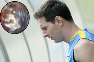 Perro 'se enoja' al escuchar la palabra Messi