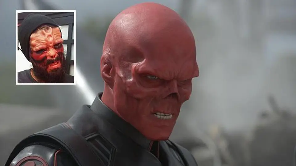 Hombre se opera para ser como Red Skull