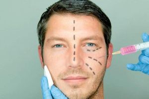 Hombres, los nuevos clientes de las cirugías plásticas