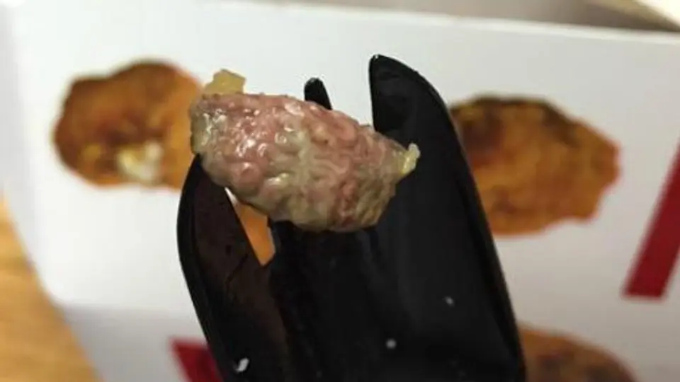 Joven encuentra pedazo de carne similar a un cerebro en su comida