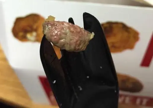 Joven encuentra pedazo de carne similar a un cerebro en su comida
