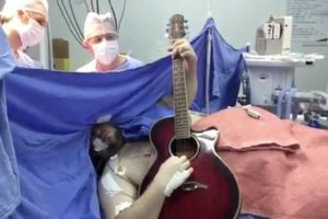 Operan del cerebro a brasileño mientras toca la guitarra