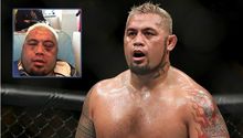 Peleador de UFC muestra su rostro tras brutal golpiza