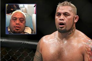 Peleador de UFC muestra su rostro tras brutal golpiza