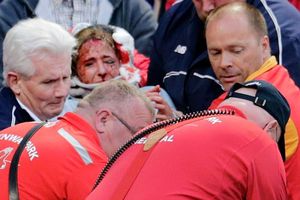 Mujer recibe batazo accidental en partido de Medias Rojas