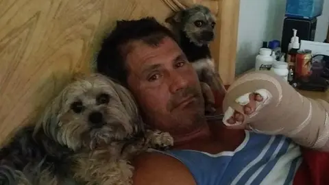 Canseco asegura que subastará el dedo que se le desprendió