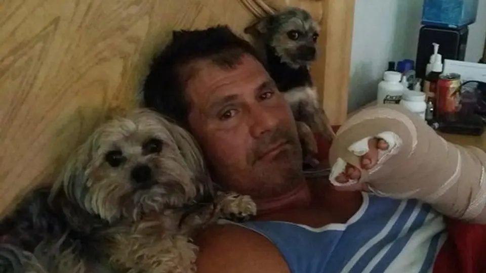 Canseco asegura que subastará el dedo que se le desprendió