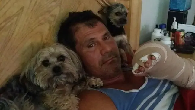 Canseco asegura que subastará el dedo que se le desprendió