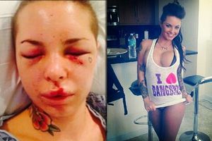 Ex peleador deja irreconocible a actriz porno