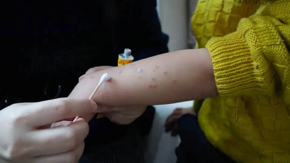 Especialistas advierten sobre los riesgos de no vacunar a tiempo, principalmente en bebés y niñas y niños pequeños. / iStock