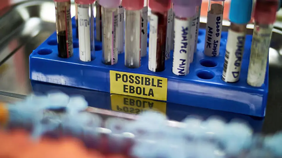 Alerta sanitaria en Brasil por sospechoso caso de ébola. / iStock