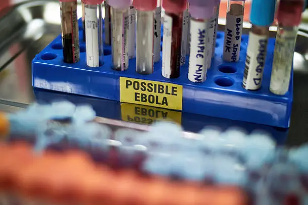 Alerta sanitaria en Brasil por sospechoso caso de ébola. / iStock
