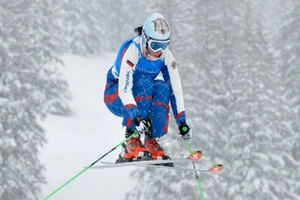 Esquiadora rusa sufre terrible lesión en Sochi