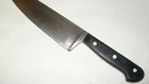 Mujer vivió 37 años con pedazo de cuchillo en el hombro