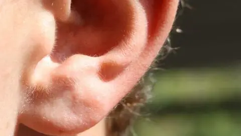 Por apuesta, dos hombres se cortan una oreja