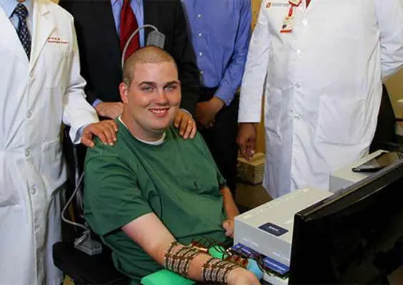 Bypass cerebral para tratar la cuadripléjia