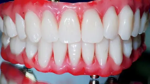 Científicos usan orina humana para crear dientes