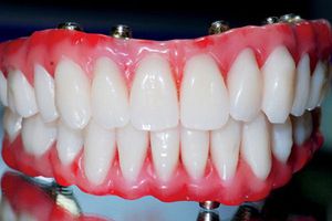 Científicos usan orina humana para crear dientes