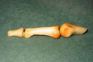 Hombre inglés se come su dedo