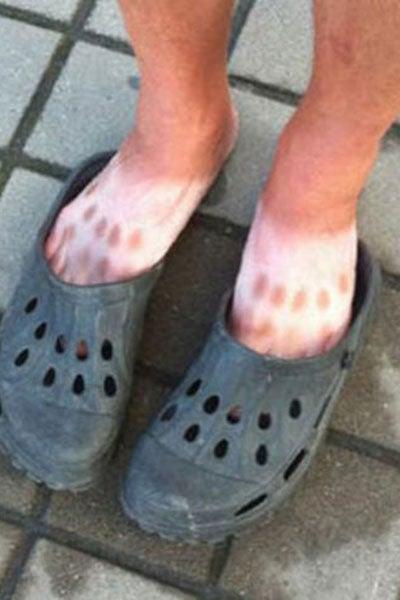 Esta persona pensó que sus pies estarán protegidos del sol en estos zapatos de goma | ESPECIAL