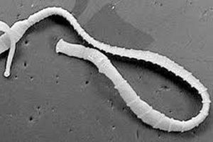 Para bajar de peso mujer se come una 'lombriz solitaria'