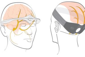 Crean gadget contra dolores de cabeza