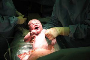 Mujer en coma da a luz en Rusia