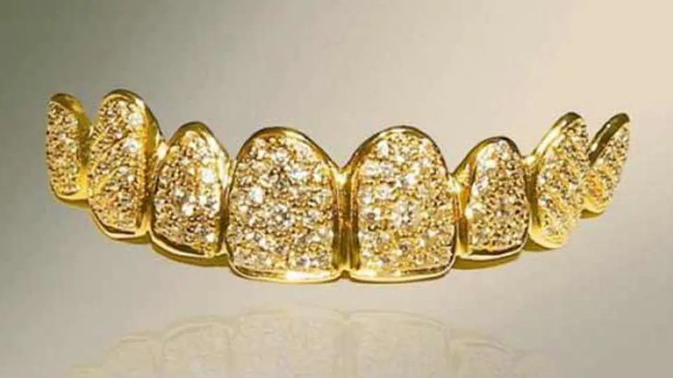 Dentadura de oro que vale 2 millones de pesos