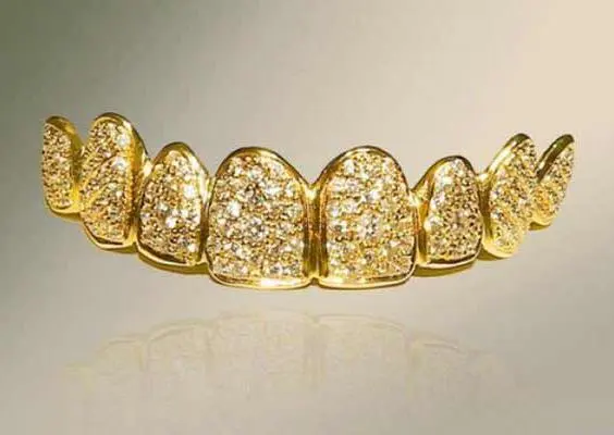 Dentadura de oro que vale 2 millones de pesos