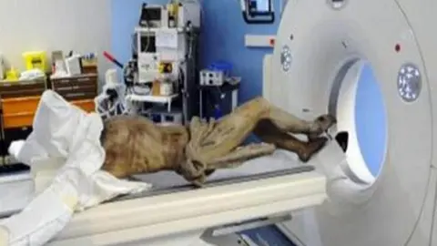 'Cristo' va al hospital para radiografía