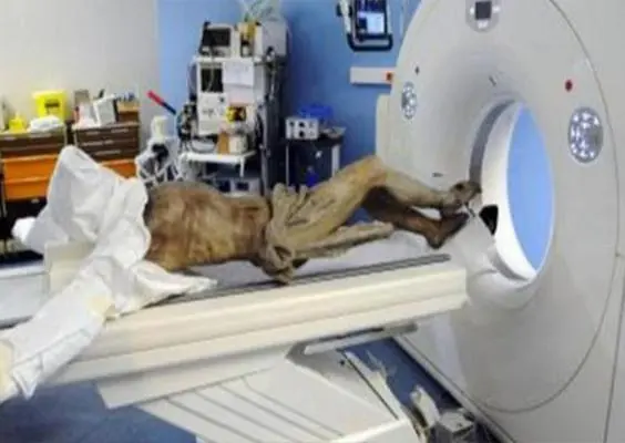'Cristo' va al hospital para radiografía