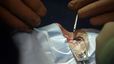 La salud visual llegó 'volando'