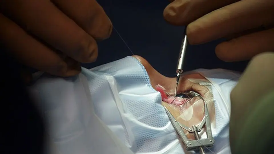 La salud visual llegó 'volando'