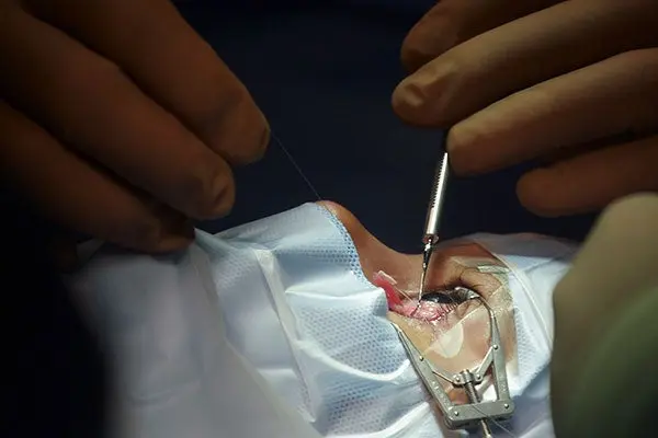 La salud visual llegó 'volando'