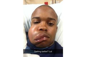 Jugador 'presume' inflamación por pelotazo de 144 kph