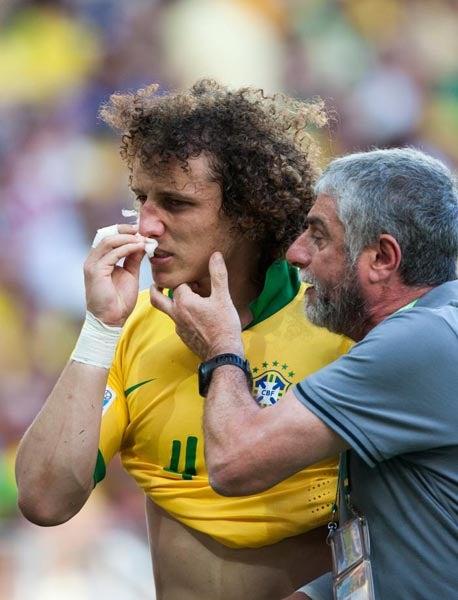 David Luiz sufrió un golpe en la nariz | BERNARDO MALDONADO