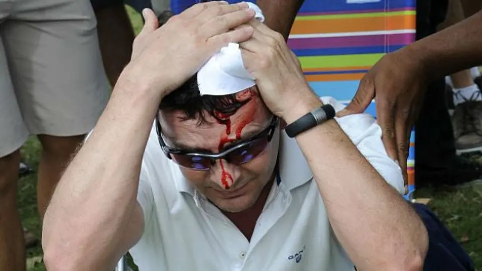 Woods descalabra por accidente a aficionado