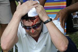 Woods descalabra por accidente a aficionado