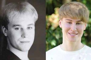 Gasta 100 mil dólares para parecerse a Justin Bieber