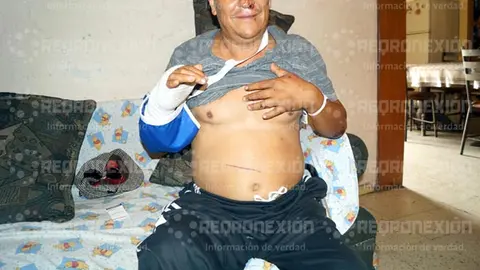 Liborio es acusado de atropello tras riña en un bar