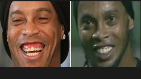 Así quedó Ronaldinho tras cirugía estética dental