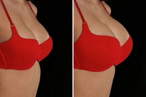 Ejército israelí recluye a una soldado por aumentarse los pechos