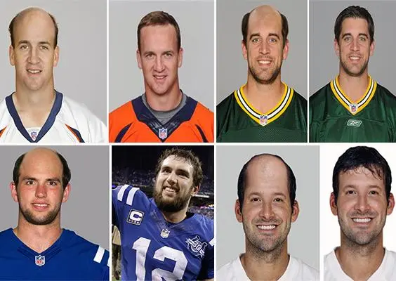 Así se verían algunos quarterback... sin pelo
