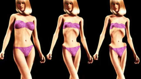 Caza-talentos buscan modelos en clínicas de anorexia