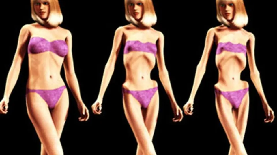 Caza-talentos buscan modelos en clínicas de anorexia