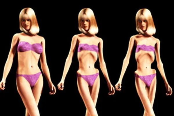 Caza-talentos buscan modelos en clínicas de anorexia