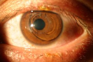 Científico inglés descubre la 'Capa Dua', otra parte del cuerpo