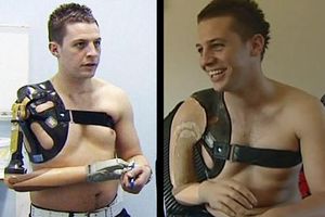 Con pensamientos controla su prótesis